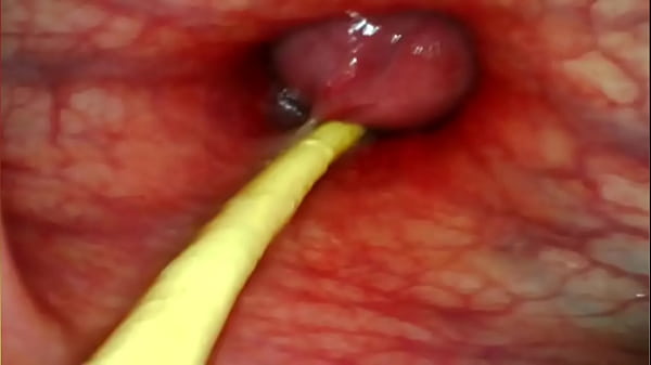 EXTREME ANAL POV. CAMERA INSIDE HER ASSHOLE AS I POUND HER WITH MY BIG COCK AND CUM DEEP INSIDE